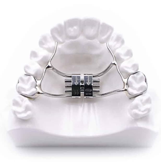 Interception